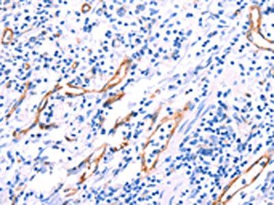 VWF Antibody