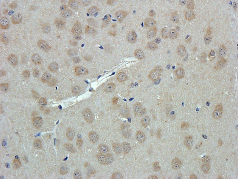 vWF antibody