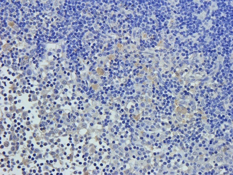 vWF antibody