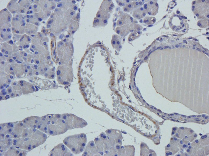 vWF antibody