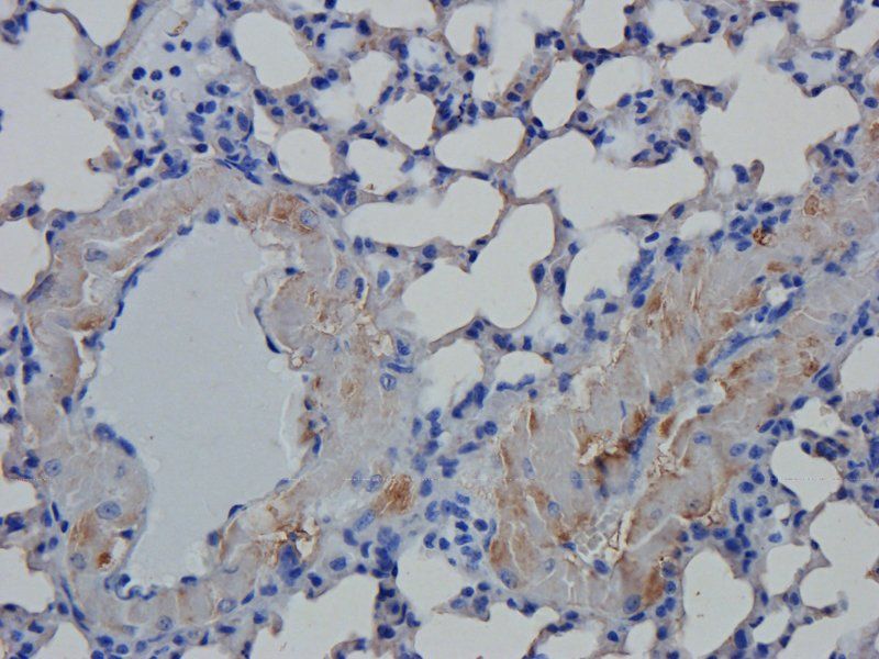 vWF antibody