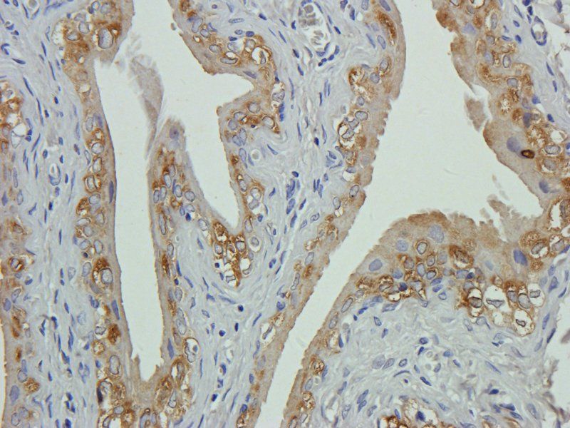 vWF antibody