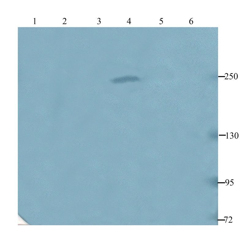 vWF antibody