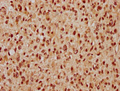 WAPL Antibody