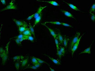 WAS Antibody