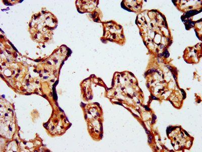 WASF2 Antibody