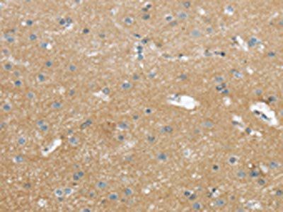 WASF2 Antibody