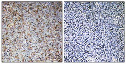 WASF2 Antibody