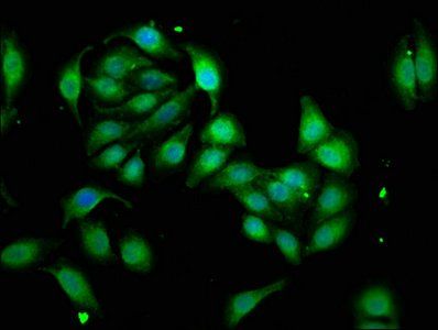 WASF3 Antibody