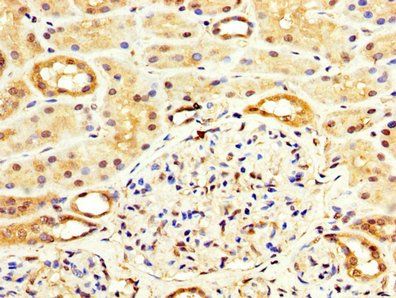 WASF3 Antibody