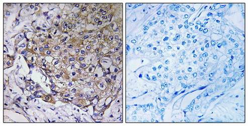 WASF3 Antibody