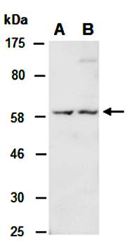 WASF3 (M1) Antibody, Rabbit Polyclonal
