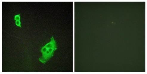 WAVE1 (Ab-125) Antibody