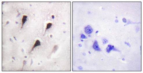 WAVE1 (Ab-125) Antibody