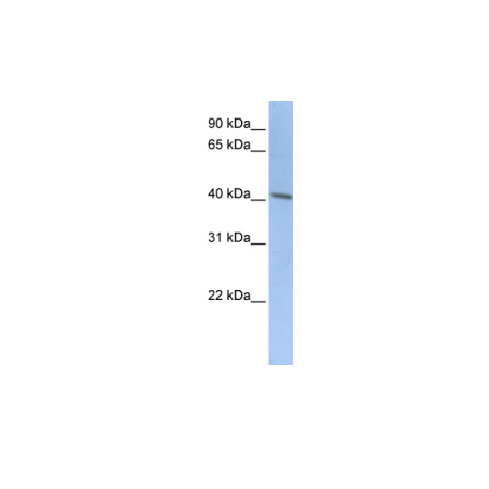 Doublecortin antibody