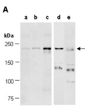 TET1 antibody