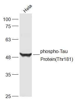 Tau Protein (phospho-Thr181) antibody