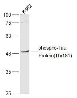 Tau Protein (phospho-Thr181) antibody