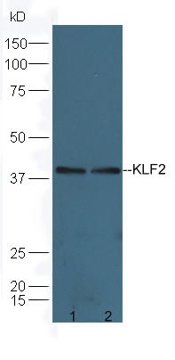 KLF2 Rabbit Polyclonal Antibody (PE)