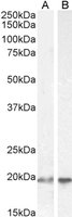 Goat anti-UBE2C / UBCH10 Antibody