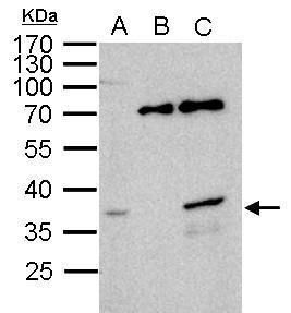 WBSCR22 antibody