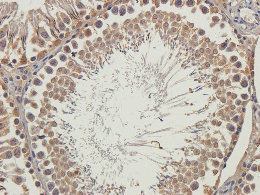 WDFY1 antibody