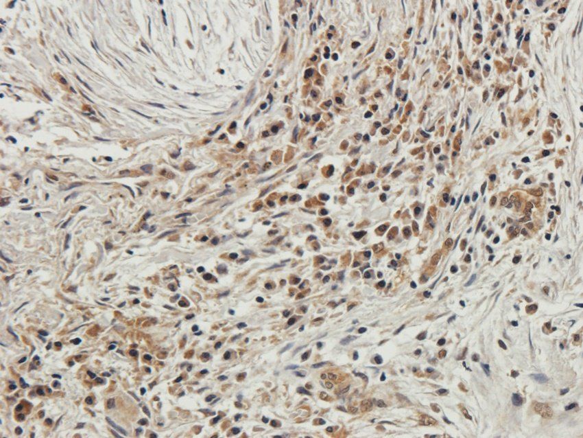 WDFY1 antibody