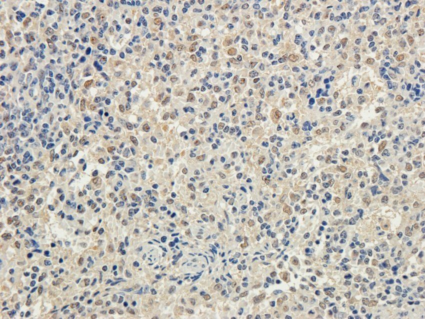 WDFY1 antibody