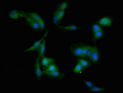 WDFY3 Antibody