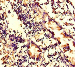 WDFY4 Antibody