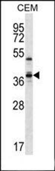 WDR25 antibody