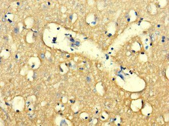 WDR27 Antibody