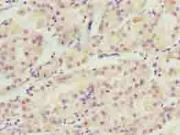 WDR34 Antibody