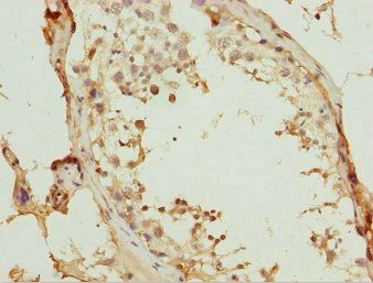WDR47 Antibody
