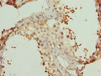 WDR47 Antibody