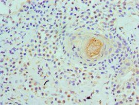 WDR5 Antibody