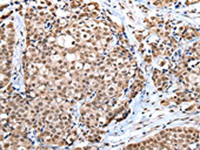 WDR5 Antibody