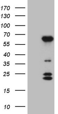 WDR61 Antibody