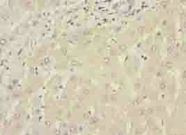 WDR74 Antibody