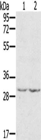 WDR83 Antibody