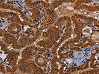 WDR83 Antibody