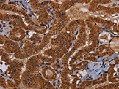 WDR83 antibody