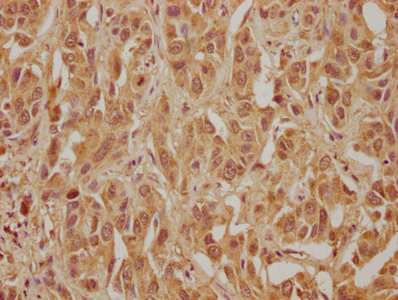 WDR83 Antibody