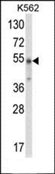 WDSUB1 antibody