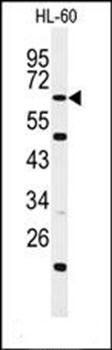 WDTC1 antibody