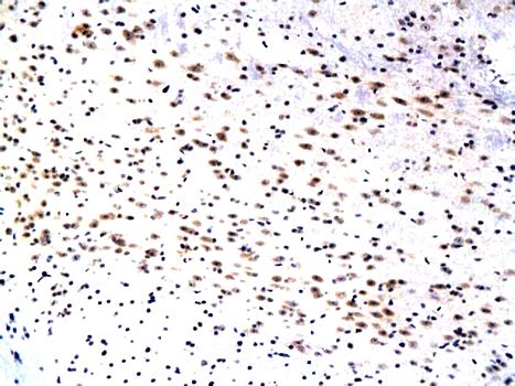 WIF1 Rabbit Polyclonal Antibody