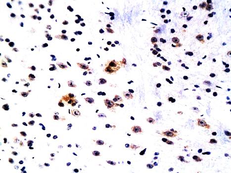 WIF1 Rabbit Polyclonal Antibody