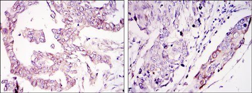 WIF1 Antibody