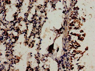 WIF1 Antibody
