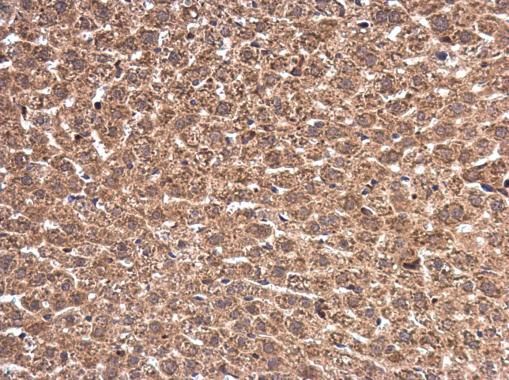 Wilms Tumor 1 antibody